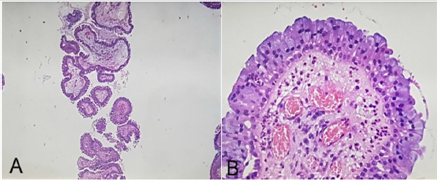 biomedres-openaccess-journal-bjstr