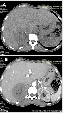 biomedres-openaccess-journal-bjstr