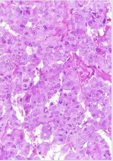 biomedres-openaccess-journal-bjstr