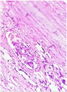 biomedres-openaccess-journal-bjstr