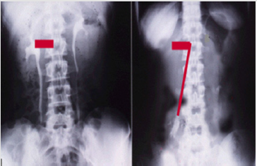 biomedres-openaccess-journal-bjstr
