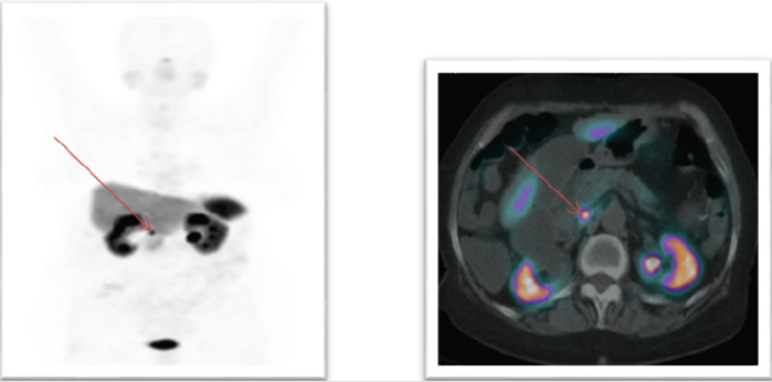 biomedres-openaccess-journal-bjstr