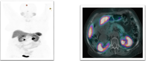 biomedres-openaccess-journal-bjstr