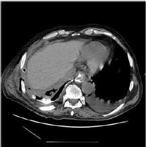 biomedres-openaccess-journal-bjstr