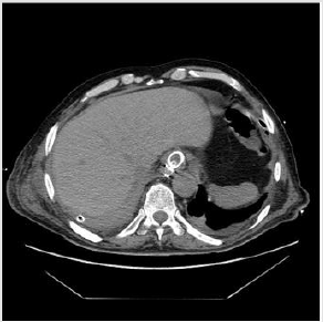 biomedres-openaccess-journal-bjstr