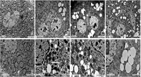 biomedres-openaccess-journal-bjstr