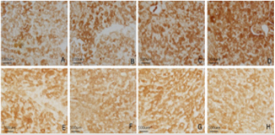 biomedres-openaccess-journal-bjstr