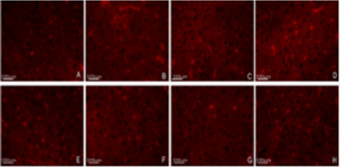 biomedres-openaccess-journal-bjstr