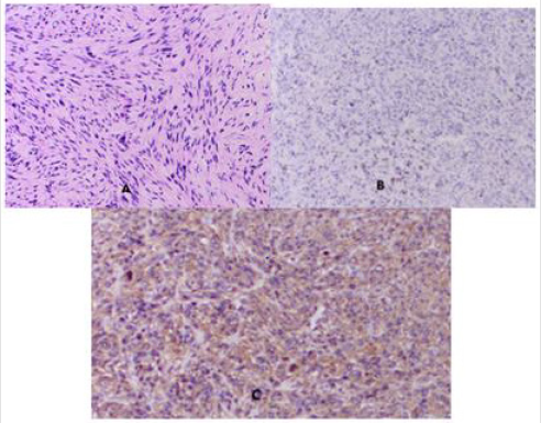biomedres-openaccess-journal-bjstr