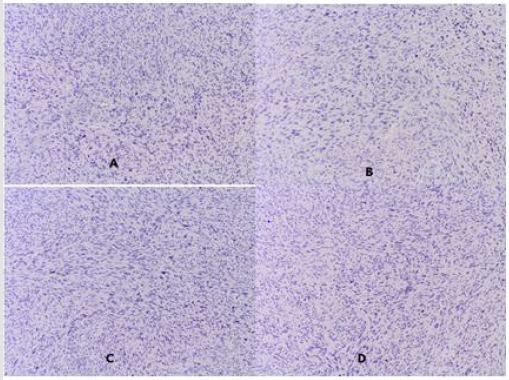 biomedres-openaccess-journal-bjstr