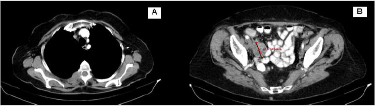biomedres-openaccess-journal-bjstr