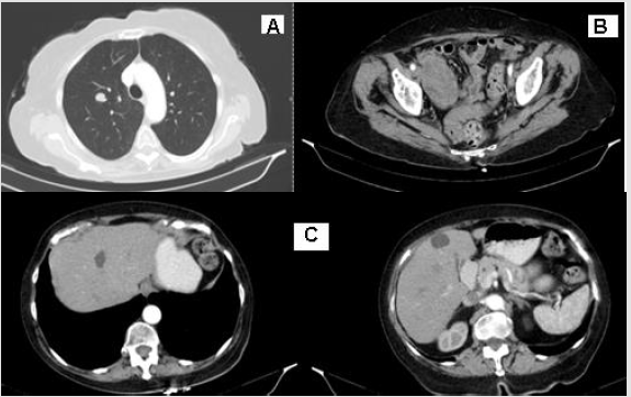 biomedres-openaccess-journal-bjstr