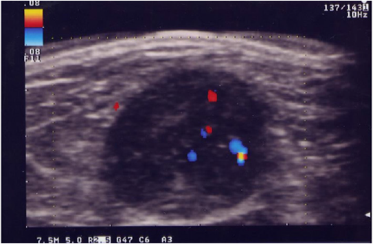 biomedres-openaccess-journal-bjstr