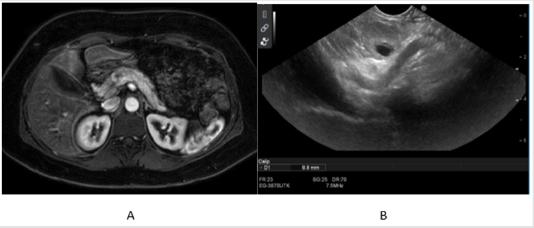 biomedres-openaccess-journal-bjstr
