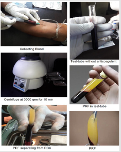 biomedres-openaccess-journal-bjstr