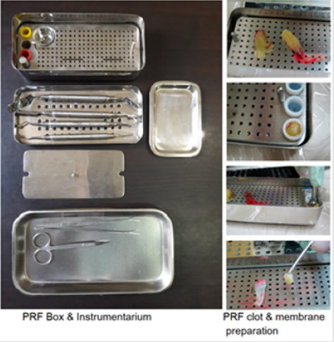 biomedres-openaccess-journal-bjstr