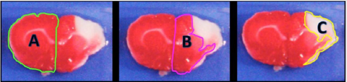 biomedres-openaccess-journal-bjstr