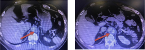 biomedres-openaccess-journal-bjstr