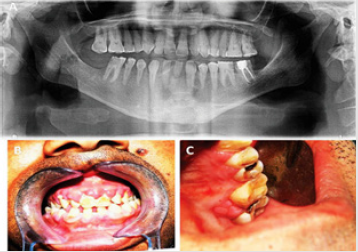 biomedres-openaccess-journal-bjstr