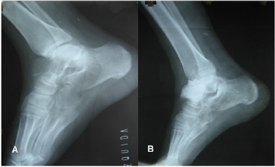 biomedres-openaccess-journal-bjstr