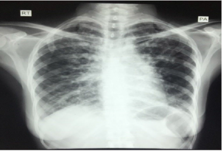 biomedres-openaccess-journal-bjstr