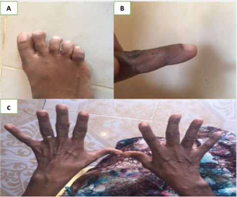 biomedres-openaccess-journal-bjstr