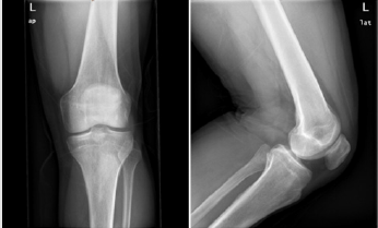 biomedres-openaccess-journal-bjstr