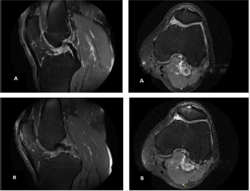 biomedres-openaccess-journal-bjstr