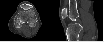 biomedres-openaccess-journal-bjstr