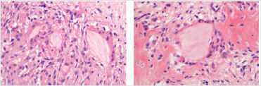 biomedres-openaccess-journal-bjstr