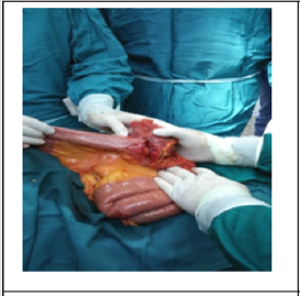 biomedres-openaccess-journal-bjstr