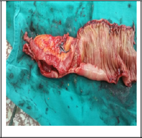 biomedres-openaccess-journal-bjstr