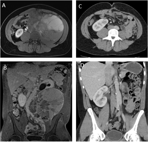 biomedres-openaccess-journal-bjstr