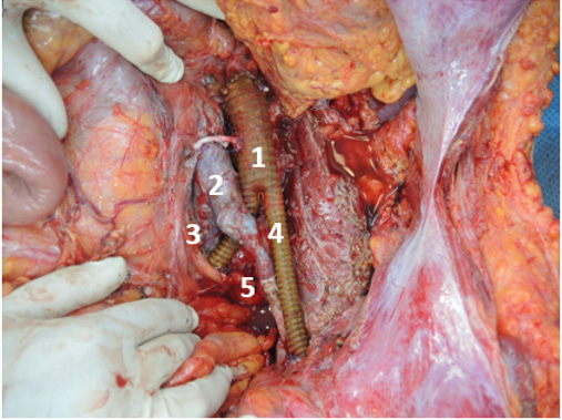 biomedres-openaccess-journal-bjstr