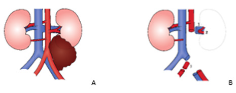 biomedres-openaccess-journal-bjstr