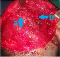 biomedres-openaccess-journal-bjstr