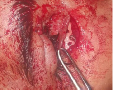 biomedres-openaccess-journal-bjstr