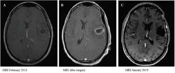 biomedres-openaccess-journal-bjstr