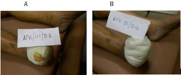 biomedres-openaccess-journal-bjstr