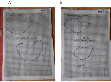 biomedres-openaccess-journal-bjstr