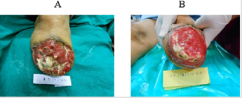 biomedres-openaccess-journal-bjstr