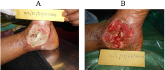 biomedres-openaccess-journal-bjstr