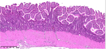 biomedres-openaccess-journal-bjstr