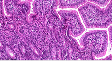 biomedres-openaccess-journal-bjstr