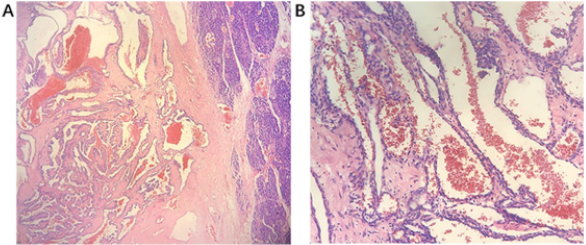 biomedres-openaccess-journal-bjstr
