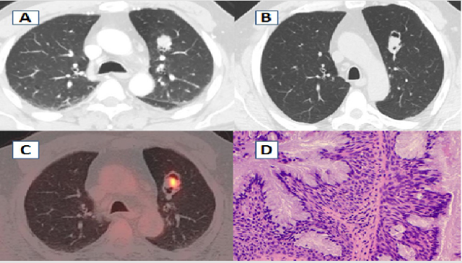 biomedres-openaccess-journal-bjstr