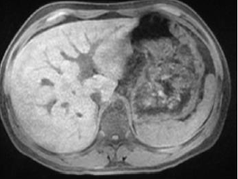 biomedres-openaccess-journal-bjstr