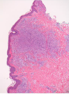 biomedres-openaccess-journal-bjstr