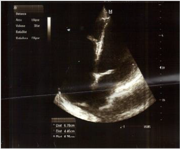 biomedres-openaccess-journal-bjstr