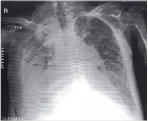 biomedres-openaccess-journal-bjstr